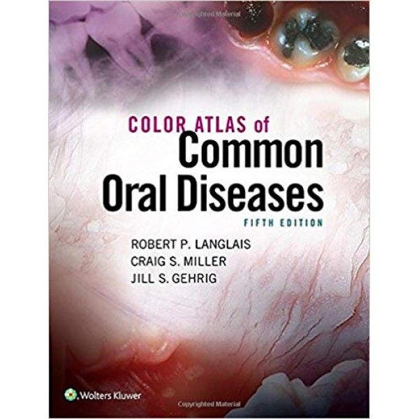 Color Atlas of Common Oral Diseases ,5 th Edition