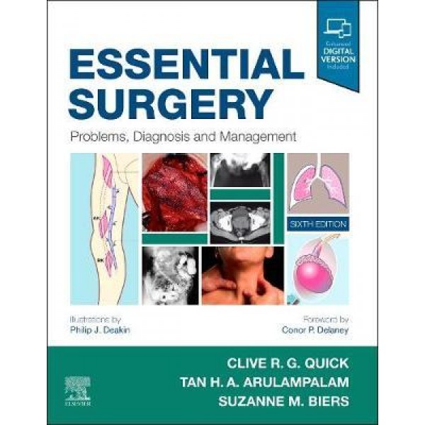Essential Surgery : Problems, Diagnosis and Management 6th Edition,  Quick 