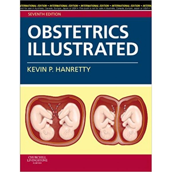 Obstetrics Illustrated 7th Edition, Kevin P. Hanretty