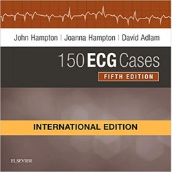 150 Ecg Cases 5th Edition, John Hampton