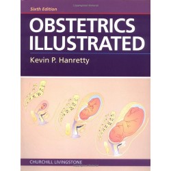 Obstetrics Illustrated 6 Edition, Kevin P. Hanretty