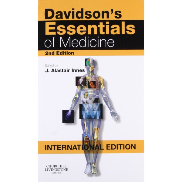 Davidson's Essentials of Medicine 2nd Edition, J. Alastair Innes
