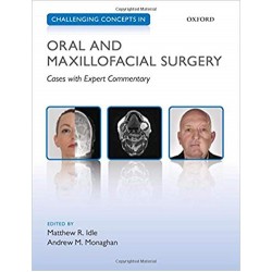 Challenging Concepts in Oral and Maxillofacial Surgery, Idle