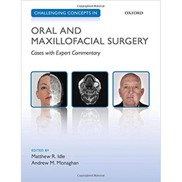 Challenging Concepts in Oral and Maxillofacial Surgery, Idle